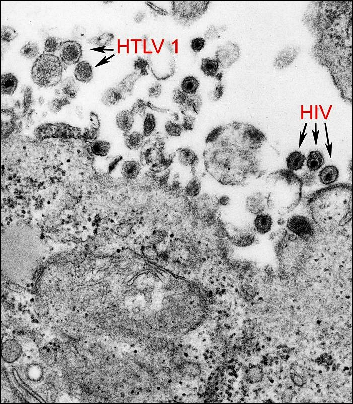 HTLV-1_and_HIV-1_EM_8241_lores